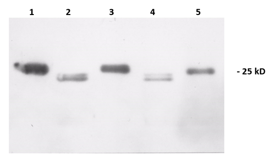western blot using anti-Lhcb2 antibodies
